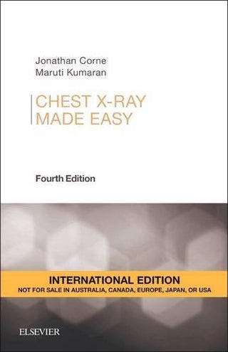 Chest X-Ray Made Easy