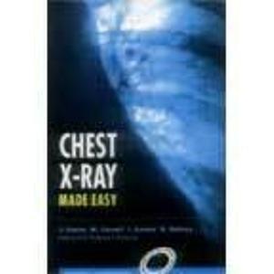 Chest X-ray Made Easy - Thryft