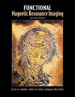 Functional Magnetic Resonance Imaging - Thryft