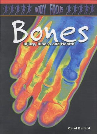 Bones - Injury, Illness And Health - Thryft